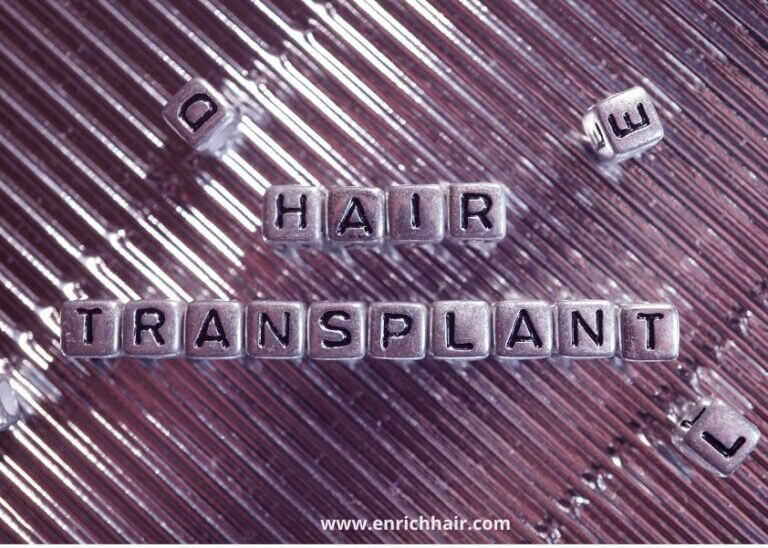Attention: Who Should Get A Hair Transplant?